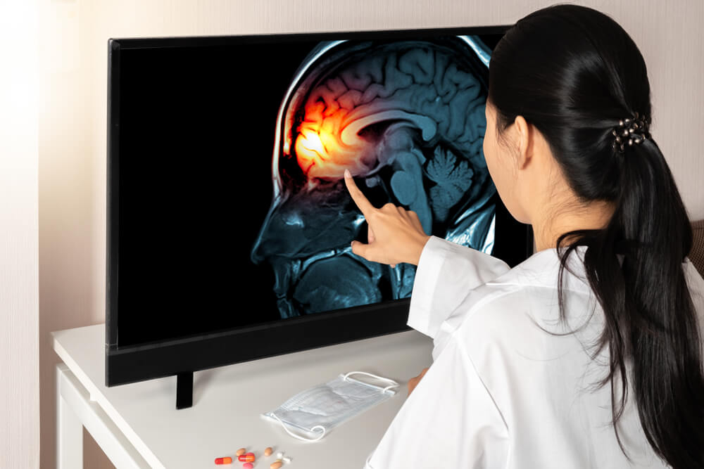 a doctor pointing to a highlighted part of the brain on a computer screen indicating brain damage