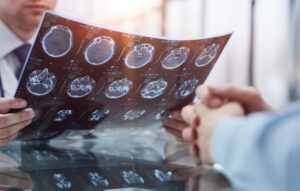 A doctor reviews a brain scan with a patient, discussing medical findings and potential treatment options.