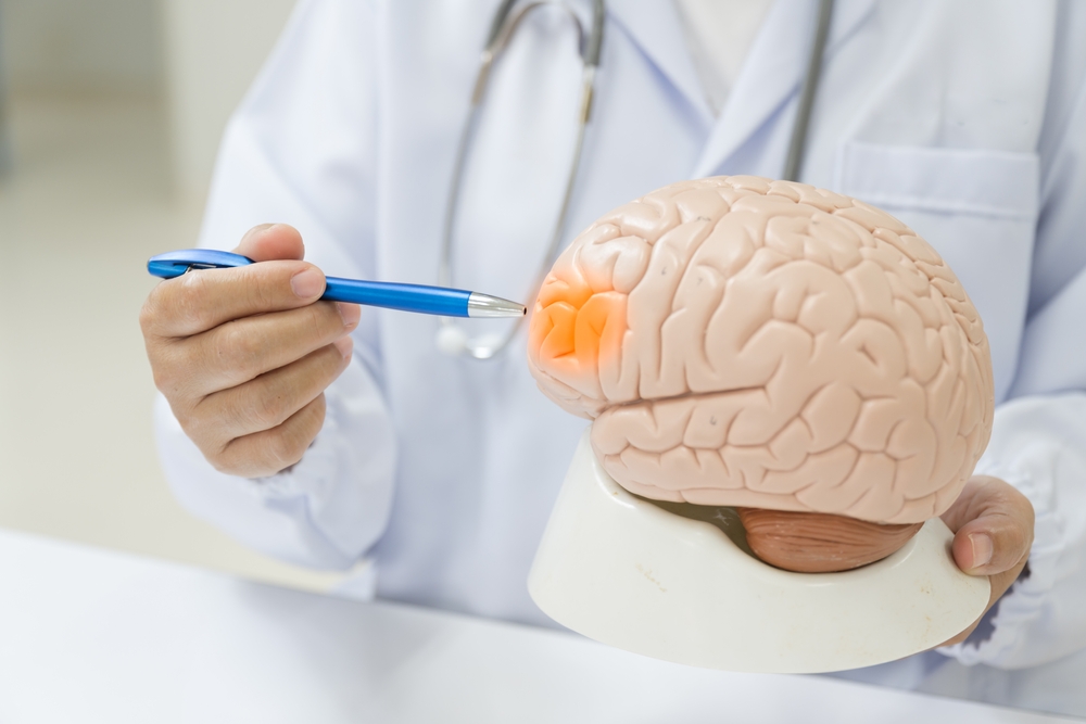 A neurologist points to a brain model, highlighting disease lesions for medical study and education.