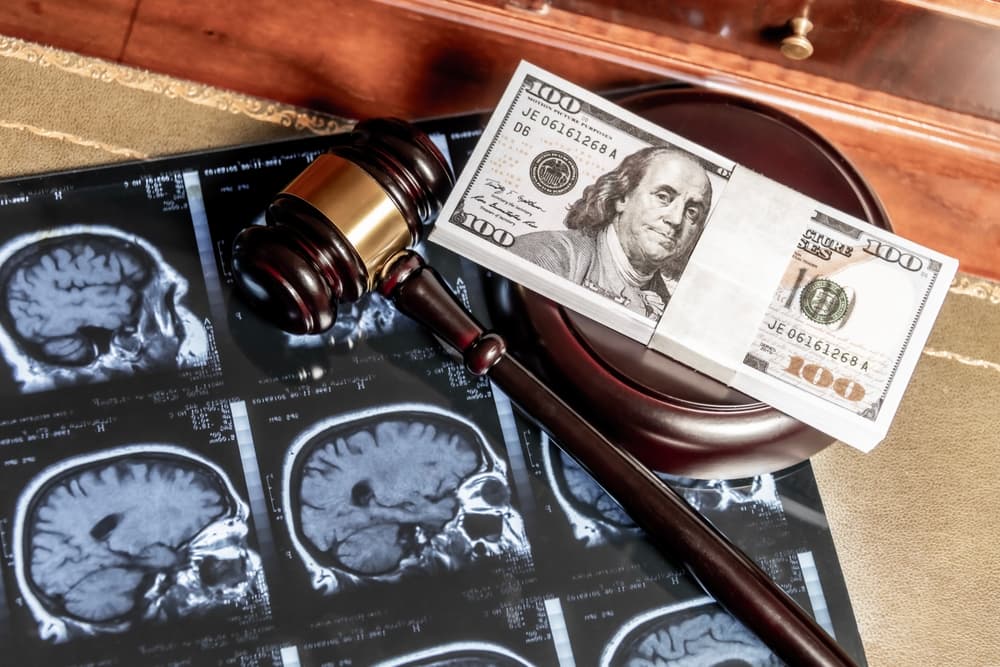 A blend of legal and medical themes featuring brain MRI scans, a gavel, and U.S. currency.