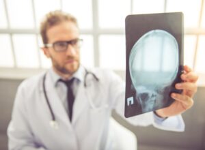 Medical doctor in white coat is examining radiograph of Head while working in his office