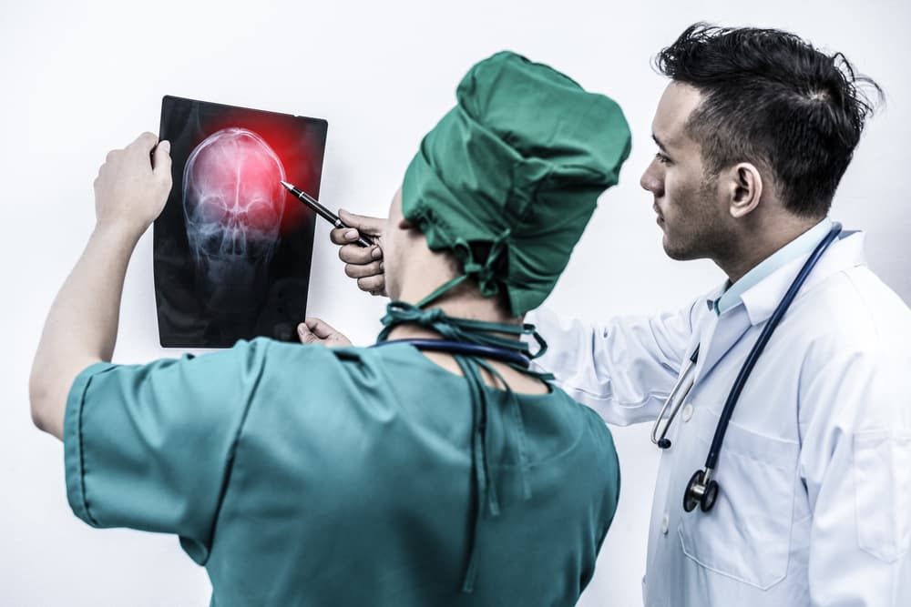 Doctor and surgeon examining x-ray film of patient 's head for brain, skull injury.